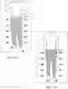 Fig. 16 - Active knit compression garments, devices and related methods