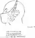 Fig. 09 - Mask Adjunct Device
