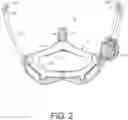 Fig. 03 - Helmet fit system