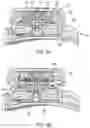 Fig. 05 - REEL BASED CLOSURE DEVICE