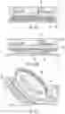 Fig. 07 - REEL BASED CLOSURE DEVICE