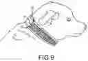 Fig. 07 - Device for use in the removal of nail polish from a person's nails