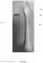 Fig. 07 - BIODEGRADABLE TOOTH BRUSH REPLACEMENT HEAD