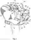 Fig. 02 - Multiple position baby carrier