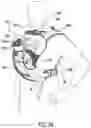 Fig. 05 - Multiple position baby carrier