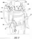 Fig. 20 - Multiple position baby carrier