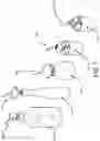Fig. 06 - Flavor dispensing drinking straw