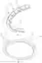 Fig. 14 - Kettle