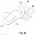 Fig. 09 - Endoscope with rotary drum and operating method
