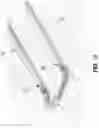 Fig. 08 - METHOD AND APPARATUS FOR MANIPULATING THE SIDE WALL OF A BODY LUMEN OR BODY CAVITY SO AS TO PROVIDE INCREASED VISUALIZATION OF THE SAME AND/OR INCREASED ACCESS TO THE SAME, AND/OR FOR STABILIZING INSTRUMENTS RELATIVE TO THE SAME