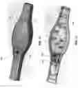 Fig. 37 - METHOD AND APPARATUS FOR MANIPULATING THE SIDE WALL OF A BODY LUMEN OR BODY CAVITY SO AS TO PROVIDE INCREASED VISUALIZATION OF THE SAME AND/OR INCREASED ACCESS TO THE SAME, AND/OR FOR STABILIZING INSTRUMENTS RELATIVE TO THE SAME