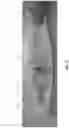 Fig. 42 - METHOD AND APPARATUS FOR MANIPULATING THE SIDE WALL OF A BODY LUMEN OR BODY CAVITY SO AS TO PROVIDE INCREASED VISUALIZATION OF THE SAME AND/OR INCREASED ACCESS TO THE SAME, AND/OR FOR STABILIZING INSTRUMENTS RELATIVE TO THE SAME