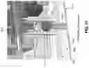 Fig. 67 - METHOD AND APPARATUS FOR MANIPULATING THE SIDE WALL OF A BODY LUMEN OR BODY CAVITY SO AS TO PROVIDE INCREASED VISUALIZATION OF THE SAME AND/OR INCREASED ACCESS TO THE SAME, AND/OR FOR STABILIZING INSTRUMENTS RELATIVE TO THE SAME