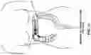 Fig. 71 - METHOD AND APPARATUS FOR MANIPULATING THE SIDE WALL OF A BODY LUMEN OR BODY CAVITY SO AS TO PROVIDE INCREASED VISUALIZATION OF THE SAME AND/OR INCREASED ACCESS TO THE SAME, AND/OR FOR STABILIZING INSTRUMENTS RELATIVE TO THE SAME