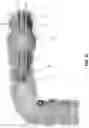 Fig. 73 - METHOD AND APPARATUS FOR MANIPULATING THE SIDE WALL OF A BODY LUMEN OR BODY CAVITY SO AS TO PROVIDE INCREASED VISUALIZATION OF THE SAME AND/OR INCREASED ACCESS TO THE SAME, AND/OR FOR STABILIZING INSTRUMENTS RELATIVE TO THE SAME