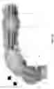 Fig. 74 - METHOD AND APPARATUS FOR MANIPULATING THE SIDE WALL OF A BODY LUMEN OR BODY CAVITY SO AS TO PROVIDE INCREASED VISUALIZATION OF THE SAME AND/OR INCREASED ACCESS TO THE SAME, AND/OR FOR STABILIZING INSTRUMENTS RELATIVE TO THE SAME