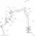 Fig. 01 - Apparatus for holding an endoscope