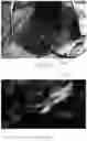 Fig. 17 - Advanced nervous tissue imaging system