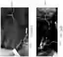 Fig. 21 - Advanced nervous tissue imaging system