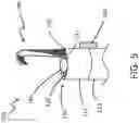 Fig. 06 - Direct endoluminal-and/or endovascular-illumination systems and methods of use thereof