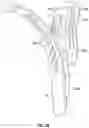 Fig. 07 - ERGONOMICALLY DESIGNED VAGINAL SPECULUM