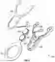 Fig. 10 - ERGONOMICALLY DESIGNED VAGINAL SPECULUM
