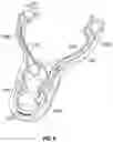Fig. 11 - ERGONOMICALLY DESIGNED VAGINAL SPECULUM