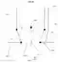Fig. 07 - CUSTOMIZED ABLATION TO CORRECT VISUAL AMETROPIA
