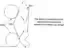 Fig. 01 - SYSTEM AND METHOD FOR MEASURING AND CORRECTING ASTIGMATISM USING LASER GENERATED CORNEAL INCISIONS