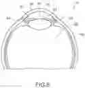 Fig. 06 - Eye examination attachment, control device, and ophthalmic microscope system