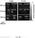 Fig. 17 - REVERSIBLY SWITCHABLE PHOTOACOUSTIC IMAGING SYSTEMS AND METHODS