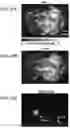 Fig. 26 - REVERSIBLY SWITCHABLE PHOTOACOUSTIC IMAGING SYSTEMS AND METHODS