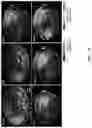 Fig. 29 - REVERSIBLY SWITCHABLE PHOTOACOUSTIC IMAGING SYSTEMS AND METHODS