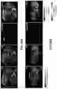 Fig. 47 - REVERSIBLY SWITCHABLE PHOTOACOUSTIC IMAGING SYSTEMS AND METHODS