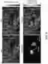 Fig. 49 - REVERSIBLY SWITCHABLE PHOTOACOUSTIC IMAGING SYSTEMS AND METHODS