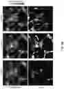 Fig. 51 - REVERSIBLY SWITCHABLE PHOTOACOUSTIC IMAGING SYSTEMS AND METHODS