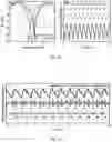 Fig. 22 - NEAR-FIELD COHERENT SENSING METHODS AND SYSTEMS