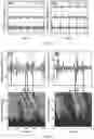 Fig. 23 - NEAR-FIELD COHERENT SENSING METHODS AND SYSTEMS