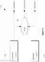 Fig. 19 - NON-INVASIVE BLOOD PRESSURE ESTIMATION AND BLOOD VESSEL MONITORING BASED ON PHOTOACOUSTIC PLETHYSMOGRAPHY