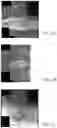 Fig. 02 - MR spectroscopy system and method for diagnosing painful and non-painful intervertebral discs