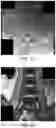 Fig. 05 - MR spectroscopy system and method for diagnosing painful and non-painful intervertebral discs