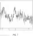 Fig. 07 - MR spectroscopy system and method for diagnosing painful and non-painful intervertebral discs