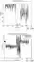 Fig. 15 - MR spectroscopy system and method for diagnosing painful and non-painful intervertebral discs