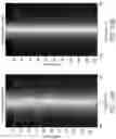 Fig. 23 - MR spectroscopy system and method for diagnosing painful and non-painful intervertebral discs
