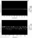 Fig. 24 - MR spectroscopy system and method for diagnosing painful and non-painful intervertebral discs