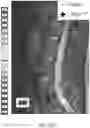 Fig. 41 - MR spectroscopy system and method for diagnosing painful and non-painful intervertebral discs