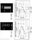 Fig. 51 - MR spectroscopy system and method for diagnosing painful and non-painful intervertebral discs