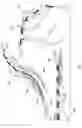 Fig. 12 - Methods and Systems for Body Lumen Medical Device Location