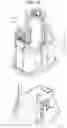 Fig. 57 - APPLICATOR FOR CONTINUOUS BLOOD GLUCOSE MEASUREMENT DEVICE