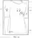 Fig. 03 - Screen Printed Electrodes For An Electrocardiogram Article